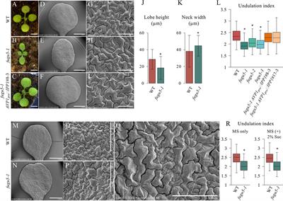 Excess Pyrophosphate Restrains Pavement Cell Morphogenesis and Alters Organ Flatness in Arabidopsis thaliana